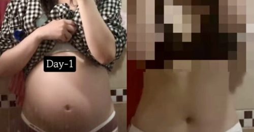 韩女怀孕36周不愿生 拍“堕胎Vlog”震惊社会